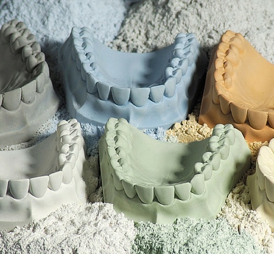 3 Things You Can Do to Prevent Gypsum Model Chipping